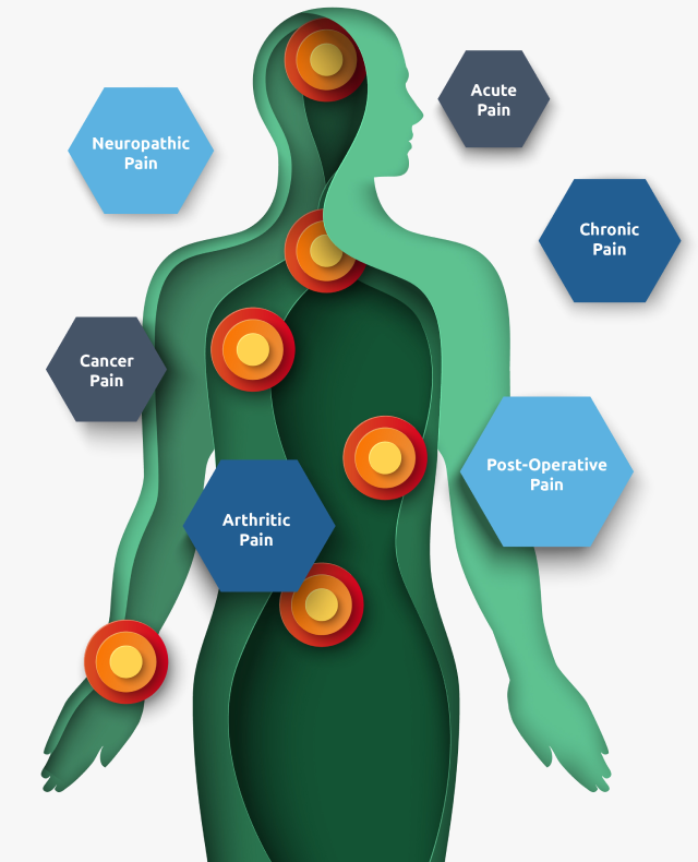 Body diagram showing various types of pain