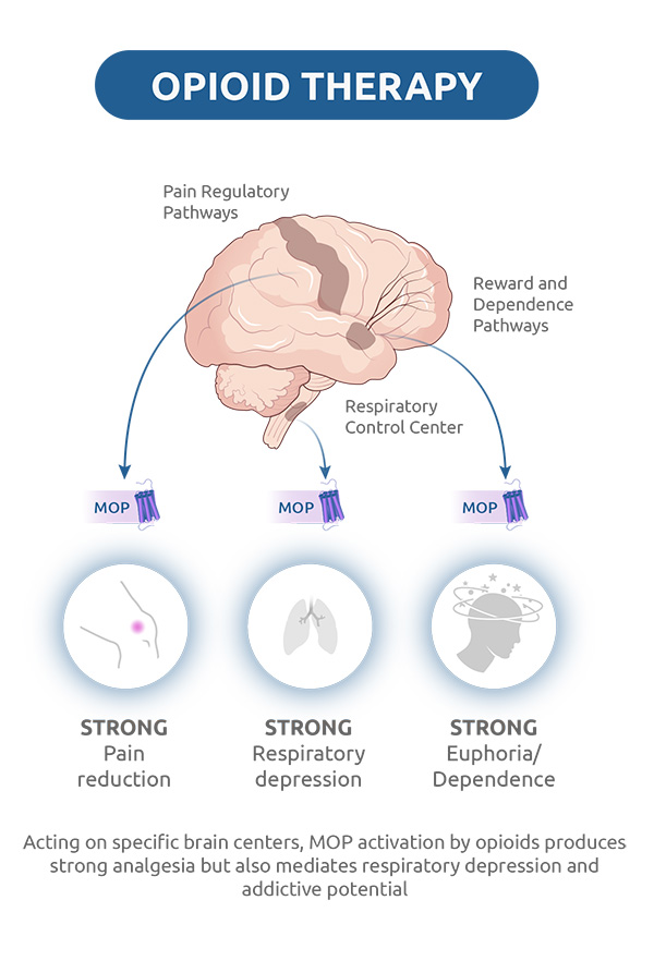 Opioid Therapy