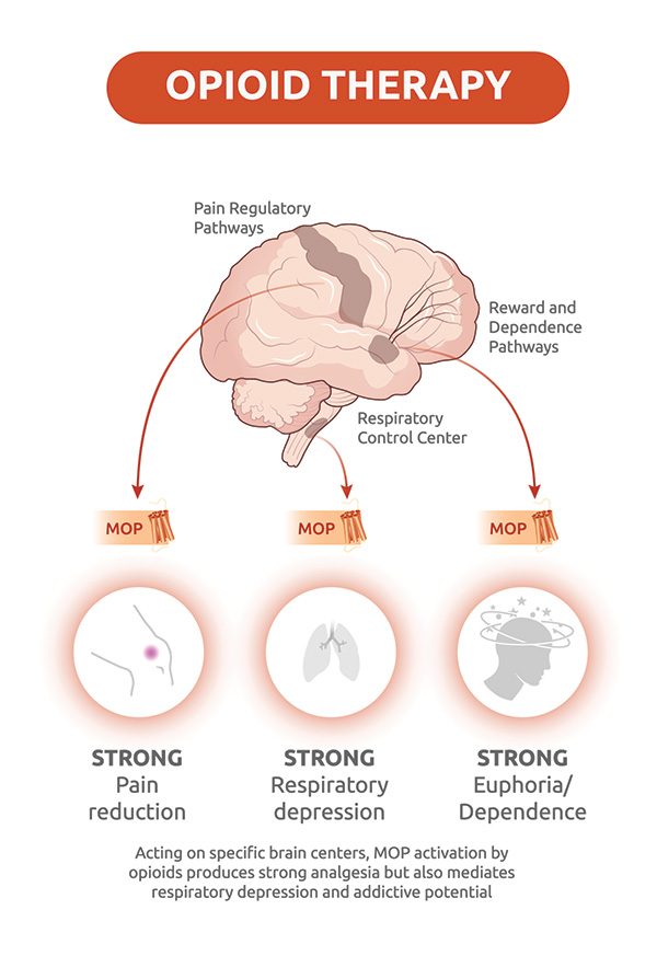 OPIOID THERAPY