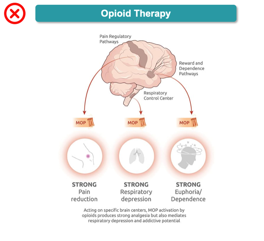 Opioid Therapy